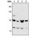 LifeSab™ CTNNB1 Rabbit pAb (50 µl)