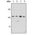 LifeSab™ KSR2 Rabbit pAb (50 µl)