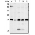LifeSab™ Caveolin 2 Rabbit pAb (50 µl)