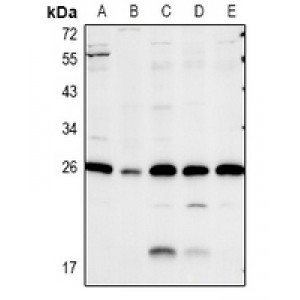 LifeSab™ Caveolin 2 Rabbit pAb (50 µl)