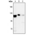 LifeSab™ EPHA8 (pY838) Rabbit pAb (50 µl)