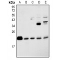 LifeSab™ RAP2B Rabbit pAb (50 µl)