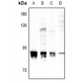 LifeSab™ PKC alpha (pS657) Rabbit pAb (50 µl)