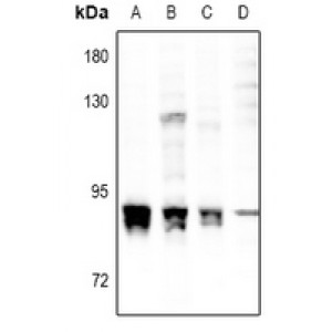 LifeSab™ PKC alpha (pS657) Rabbit pAb (50 µl)