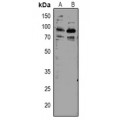 LifeSab™ TORC2 (pS171) Rabbit pAb (50 µl)