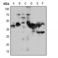 LifeSab™ NACA1 Rabbit pAb (50 µl)