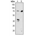 LifeSab™ SMAD4 Rabbit pAb (50 µl)
