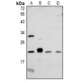LifeSab™ CMTM6 Rabbit pAb (50 µl)