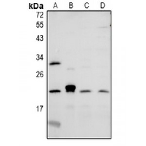 LifeSab™ CMTM6 Rabbit pAb (50 µl)