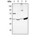 LifeSab™ DKK3 Rabbit pAb (50 µl)