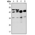 LifeSab™ RNF144B Rabbit pAb (50 µl)