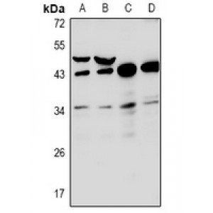 LifeSab™ RNF144B Rabbit pAb (50 µl)