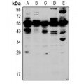 LifeSab™ HOXA5 Rabbit pAb (50 µl)