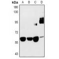 LifeSab™ SRPK3 Rabbit pAb (50 µl)