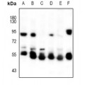 LifeSab™ Cytokeratin-5/6 Rabbit pAb (50 µl)