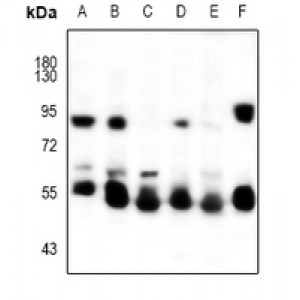 LifeSab™ Cytokeratin-5/6 Rabbit pAb (50 µl)
