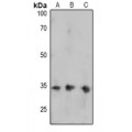 LifeSab™ FOSB (pS27) Rabbit pAb (50 µl)