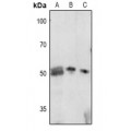 LifeSab™ p57 Kip2 (pT310) Rabbit pAb (50 µl)