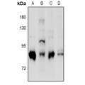 LifeSab™ PRKCD (pS664) Rabbit pAb (50 µl)