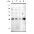 LifeSab™ RGS19 (pS151) Rabbit pAb (50 µl)