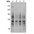 LifeSab™ CDH1 (pS844) Rabbit pAb (50 µl)