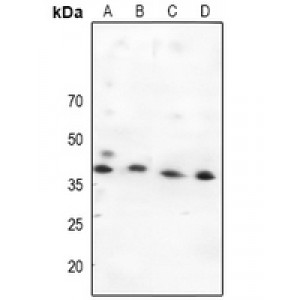 LifeSab™ MKK4 Rabbit pAb (50 µl)