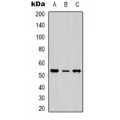 LifeSab™ NTR1 Rabbit pAb (50 µl)