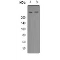 LifeSab™ mTOR (pT2446) Rabbit pAb (50 µl)