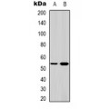 LifeSab™ SGK1 Rabbit pAb (50 µl)