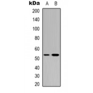 LifeSab™ p53 Rabbit pAb (50 µl)