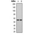 LifeSab™ Cortactin (AcK235) Rabbit pAb (50 µl)