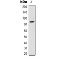 LifeSab™ TAU (AcK686) Rabbit pAb (50 µl)