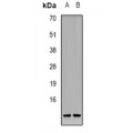 LifeSab™ CALB1 Rabbit pAb (50 µl)