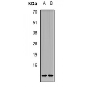 LifeSab™ CALB1 Rabbit pAb (50 µl)