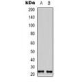 LifeSab™ BMP3A Rabbit pAb (50 µl)