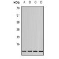 LifeSab™ Pyruvate Kinase Rabbit pAb (50 µl)