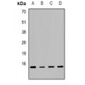 LifeSab™ RHEB Rabbit pAb (50 µl)