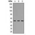 LifeSab™ Smooth Muscle Actin Rabbit pAb (50 µl)