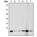 LifeSab™ Cytokeratin 18 Mouse mAb (50 µl)