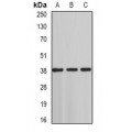 LifeSab™ ST3GAL4 Rabbit pAb (50 µl)