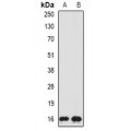 LifeSab™ SRP19 Rabbit pAb (50 µl)
