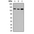 LifeSab™ HIP1 Rabbit pAb (50 µl)