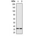LifeSab™ WBSCR22 Rabbit pAb (50 µl)