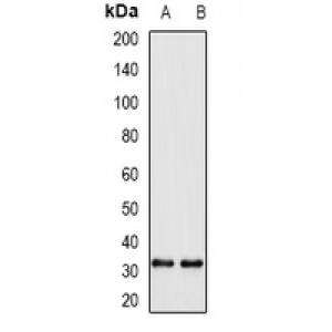 LifeSab™ WBSCR22 Rabbit pAb (50 µl)