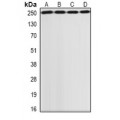 LifeSab™ GCN2 Rabbit pAb (50 µl)