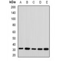 LifeSab™ RPL14 Rabbit pAb (50 µl)
