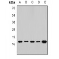 LifeSab™ RPLP1 Rabbit pAb (50 µl)
