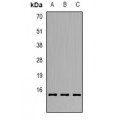 LifeSab™ GILZ Rabbit pAb (50 µl)