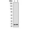 LifeSab™ CD94 Rabbit pAb (50 µl)