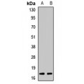 LifeSab™ Serglycin Rabbit pAb (50 µl)
